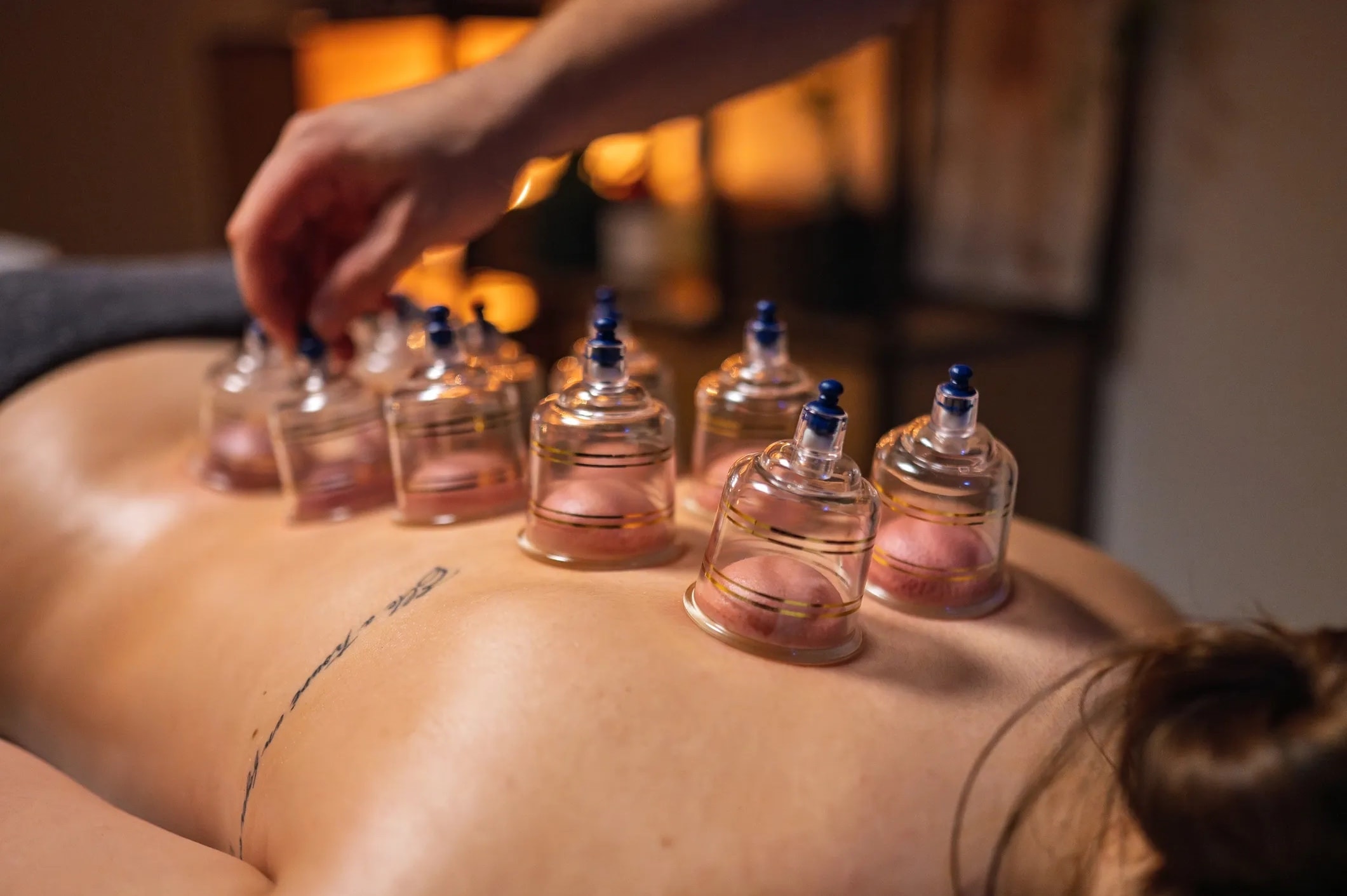 Cupping Therapy (with Massage Compressions)